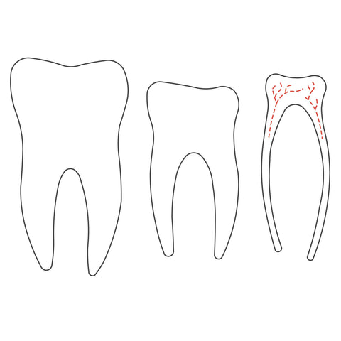 Tooth-Diagram